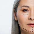 Deep Plane Facelift: La técnica de lifting facial más avanzada