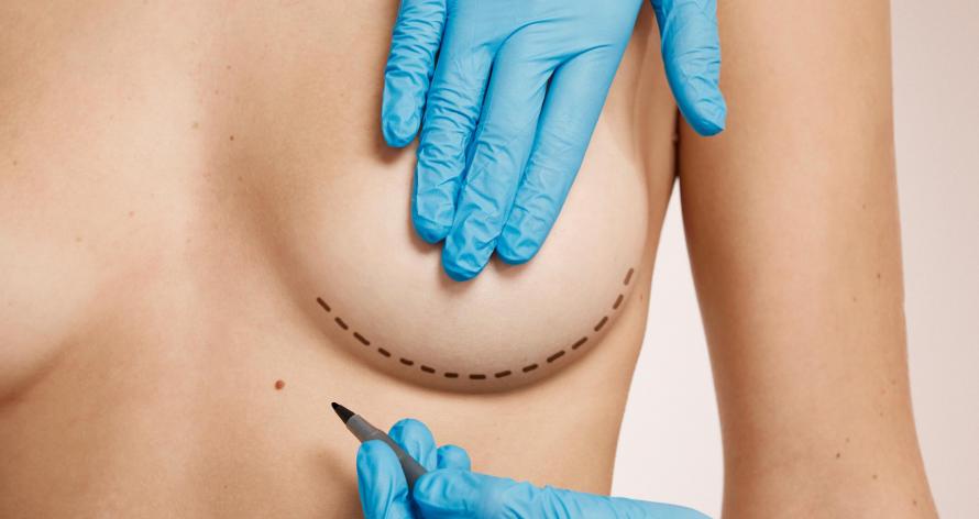 Beautiful woman with plastic surgery, depiction, plastic surgeon hands. Cosmetic surgery concept Beautiful woman with plastic surgery, depiction, plastic surgeon hands. Cosmetic surgery concept
